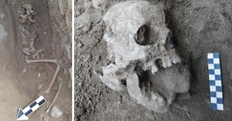 Teilweise vergrabenes menschliches Skelett mit beschädigtem Schädel in Nahaufnahme, ein Stein im Mund platziert und eine Maßstabsleiste daneben.